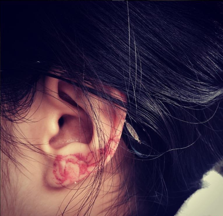 点击大图看下一张：女孩耳垂上漂亮的小清新纹身图案