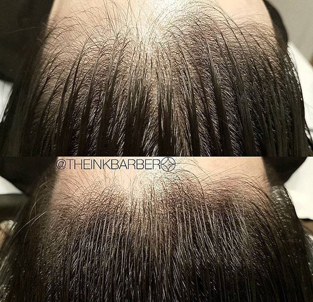 点击大图看下一张：男性头发稀疏smp头皮纹身黑色点刺技巧纹身图案