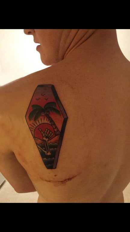 点击大图看下一张：椰树纹身图 男生背部椰树纹身图案