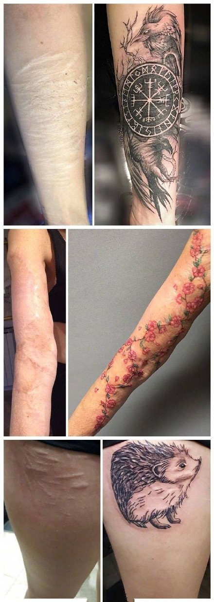 点击大图看下一张：疤痕遮盖纹身--几张优秀的疤痕遮盖纹身图案案例作品欣赏