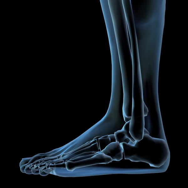 点击大图看下一张:人体x光片图片