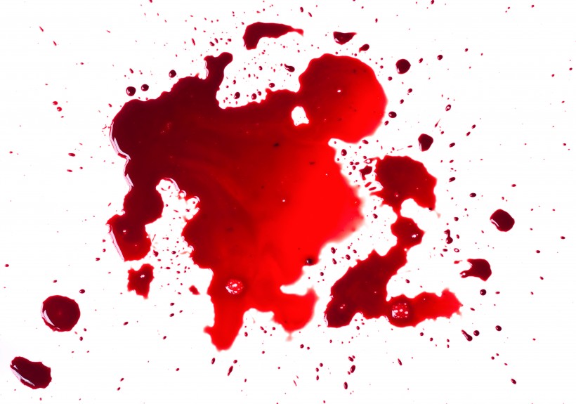 点击大图看下一张：鲜红的血迹图片