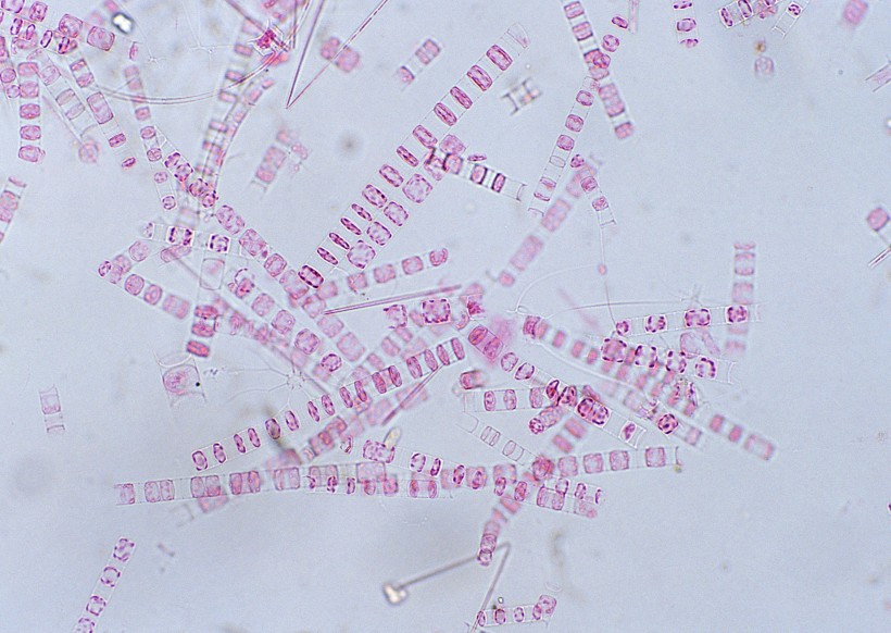 点击大图看下一张：显微镜下的细胞图片