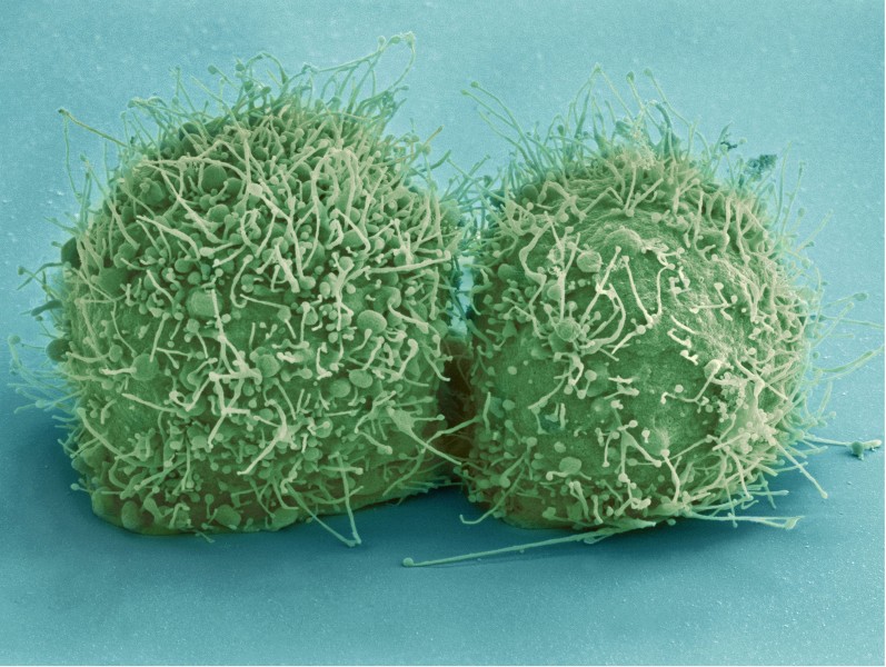 点击大图看下一张：显微镜下的细菌图片
