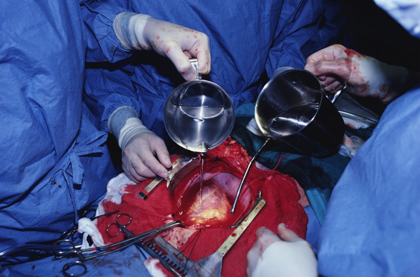 点击大图看下一张：手术台上的医护人员图片