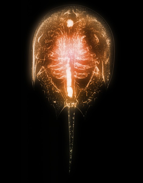 点击大图看下一张：X光下的人物图片