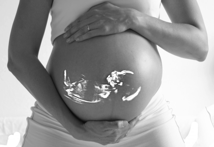 点击大图看下一张：孕妇肚子特写图片