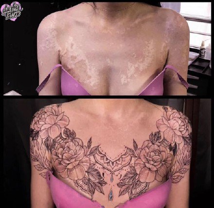 点击大图看下一张：女性腹部伤疤遮盖的一组纹身效果图