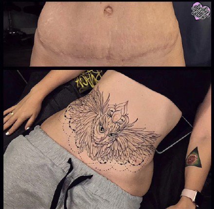 点击大图看下一张：女性腹部伤疤遮盖的一组纹身效果图