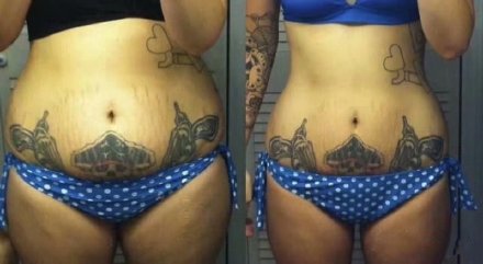 点击大图看下一张：纹身胖了会变形吗 几款胖子纹身瘦了之后的效果对比图