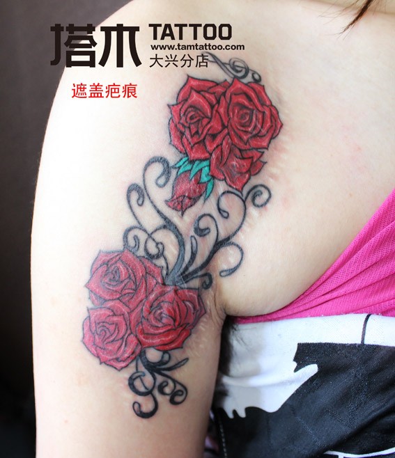 点击大图看下一张：女士玫瑰花遮盖疤痕纹身