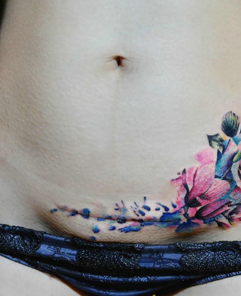 点击大图看下一张：遮盖疤痕的时尚花朵腹部纹身图案(1/1)