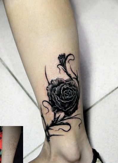 点击大图看下一张：腿部疤痕遮盖黑玫瑰纹身图案